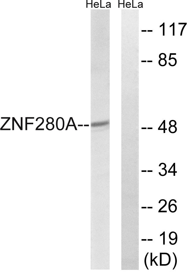 SUHW1 Rabbit Polyclonal Antibody