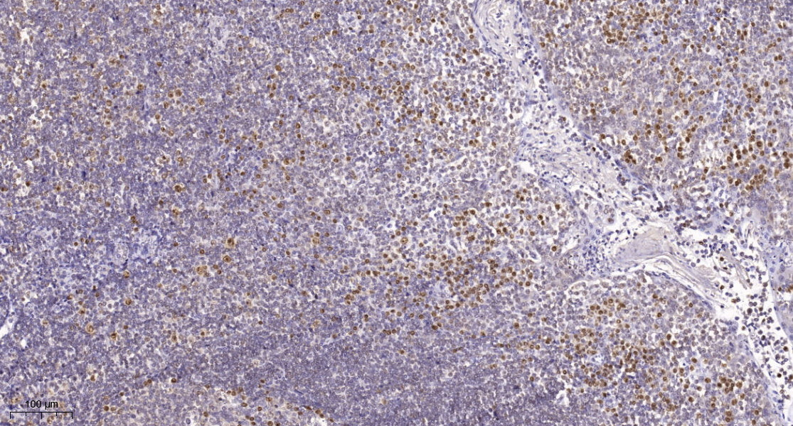SUMO2 Rabbit Polyclonal Antibody