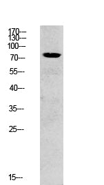 SYK Rabbit Polyclonal Antibody