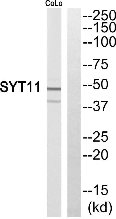 Synaptotagmin XI Rabbit Polyclonal Antibody