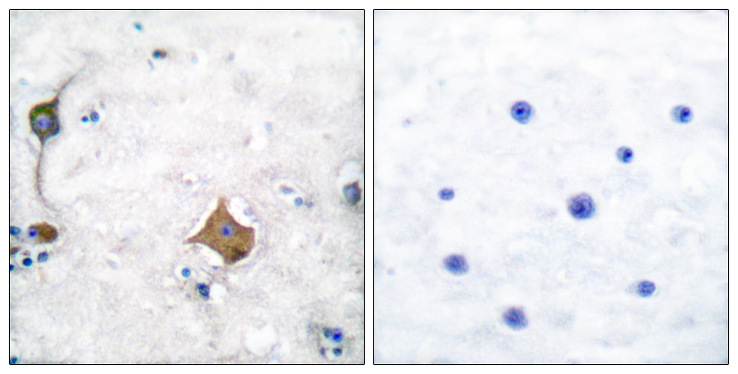 SYP Rabbit Polyclonal Antibody
