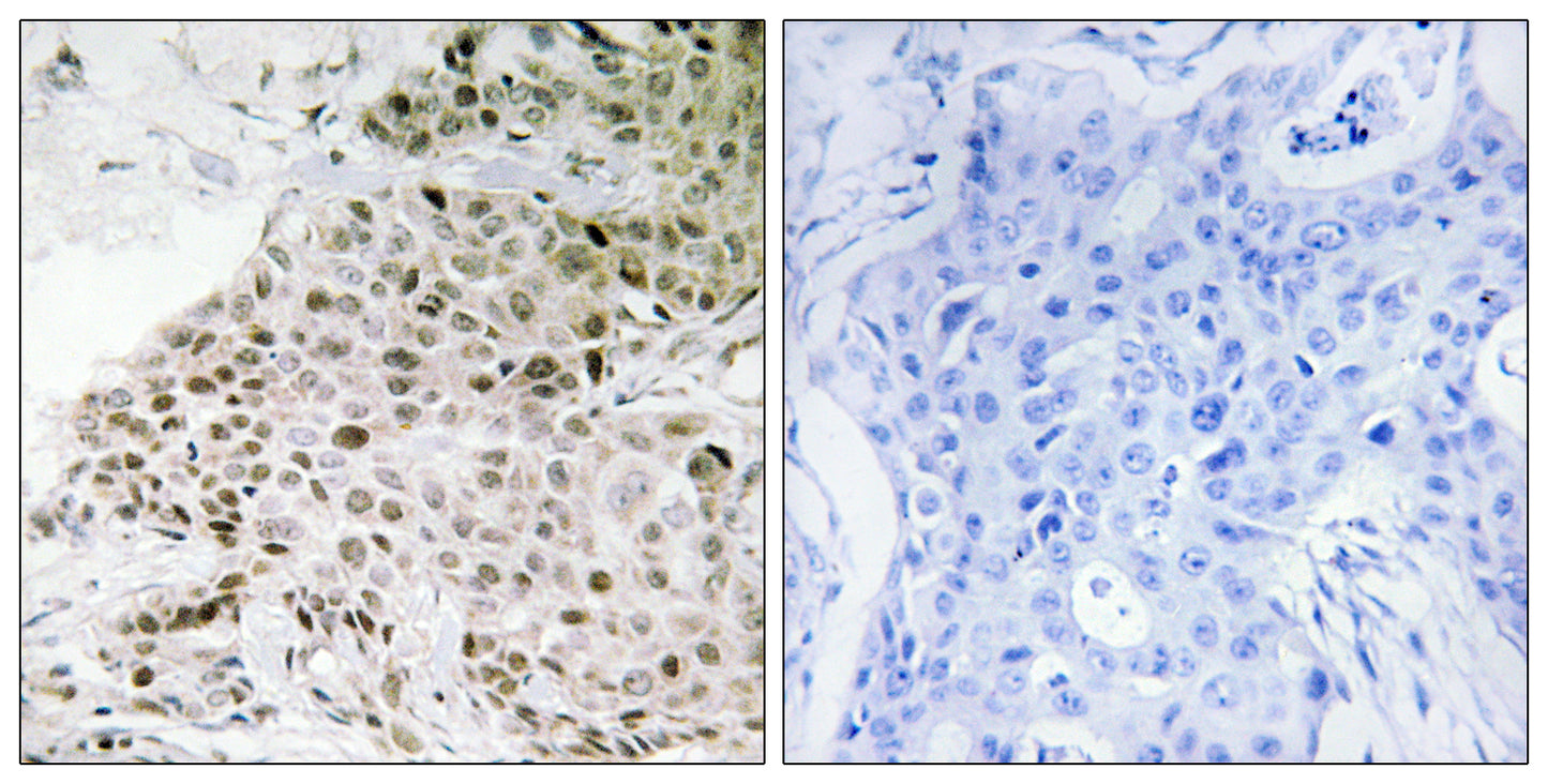 TAF II p18 Rabbit Polyclonal Antibody