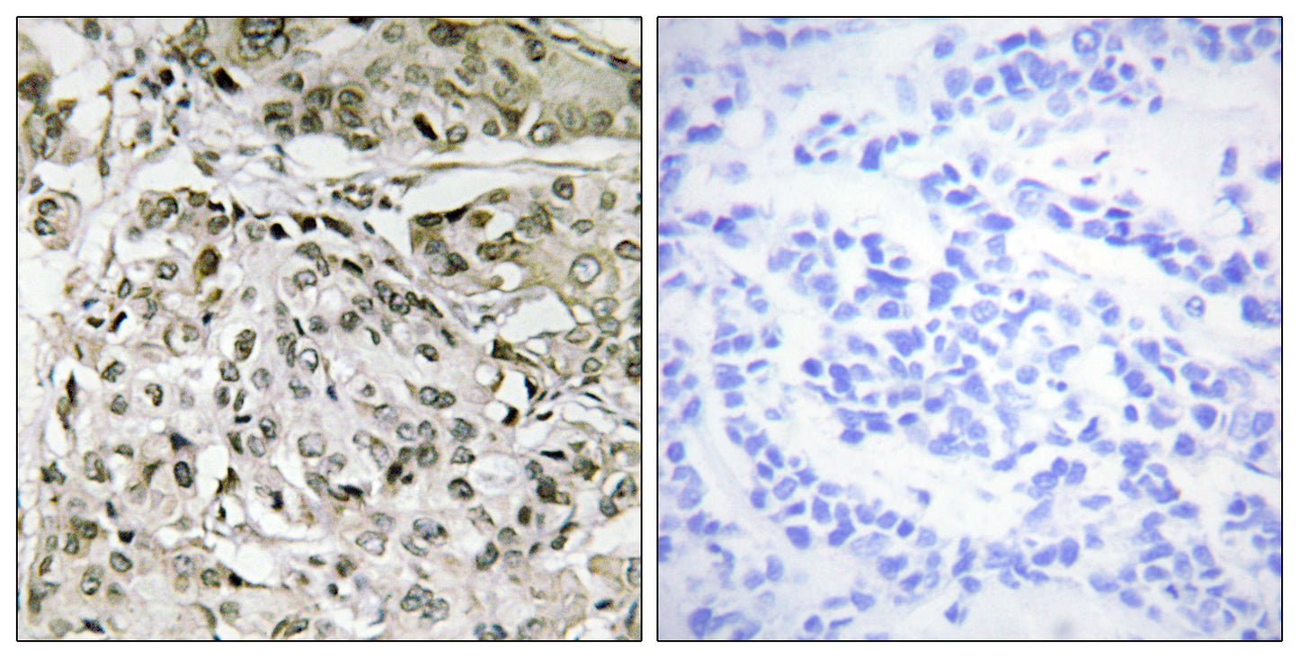 TAF II p250 Rabbit Polyclonal Antibody