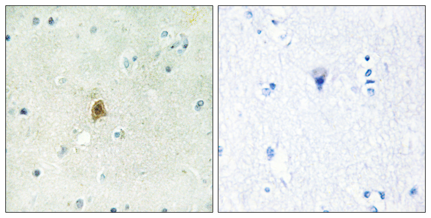 TAF II p68 Rabbit Polyclonal Antibody