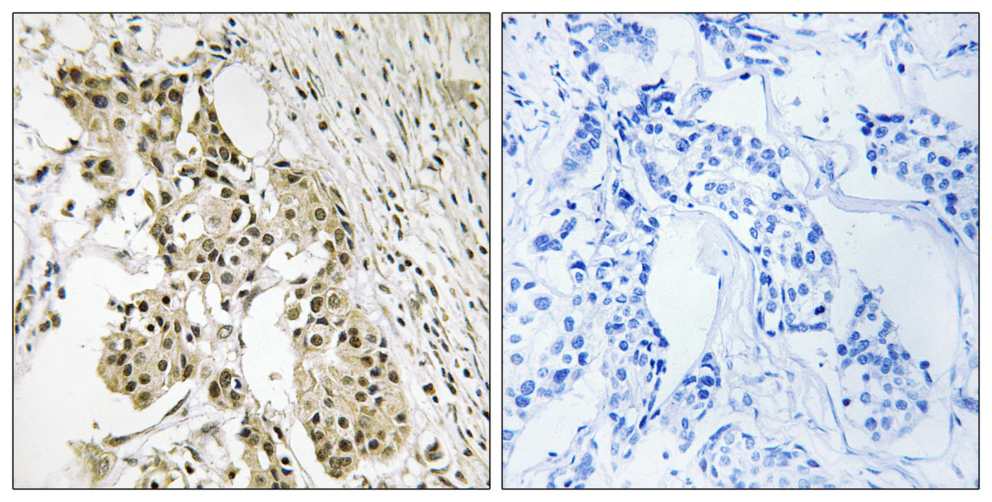 TAGAP Rabbit Polyclonal Antibody