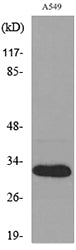 TALL-1 Rabbit Polyclonal Antibody