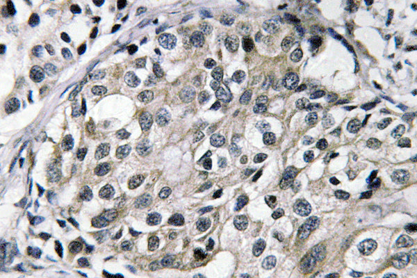 TAT Rabbit Polyclonal Antibody
