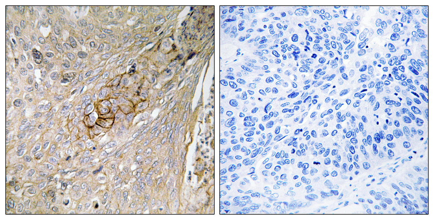 TAUT Rabbit Polyclonal Antibody