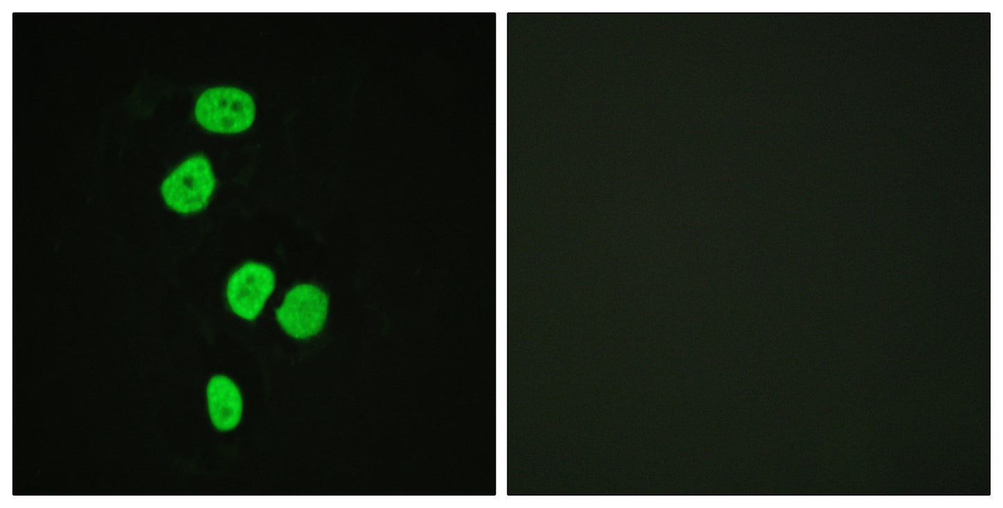 TBC1D4 Rabbit Polyclonal Antibody