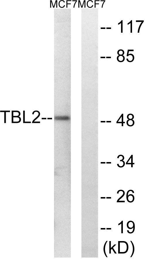 TBL2 Rabbit Polyclonal Antibody