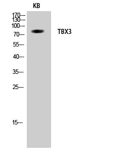 TBX3 Rabbit Polyclonal Antibody