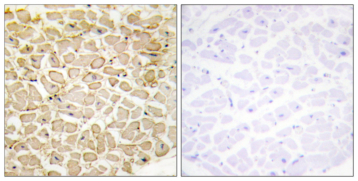 T-cadherin Rabbit Polyclonal Antibody