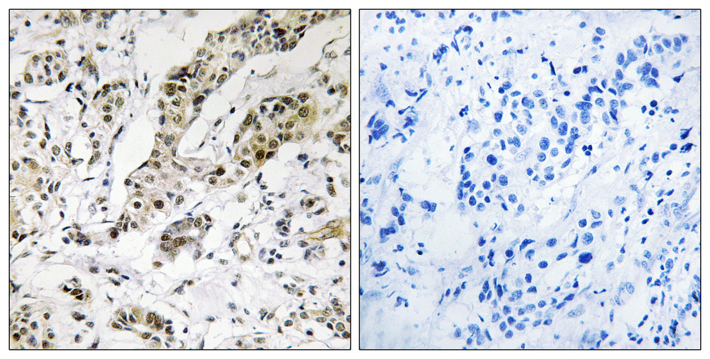 TCEAL3/5/6 Rabbit Polyclonal Antibody