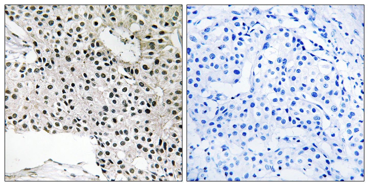 TCEAL4 Rabbit Polyclonal Antibody