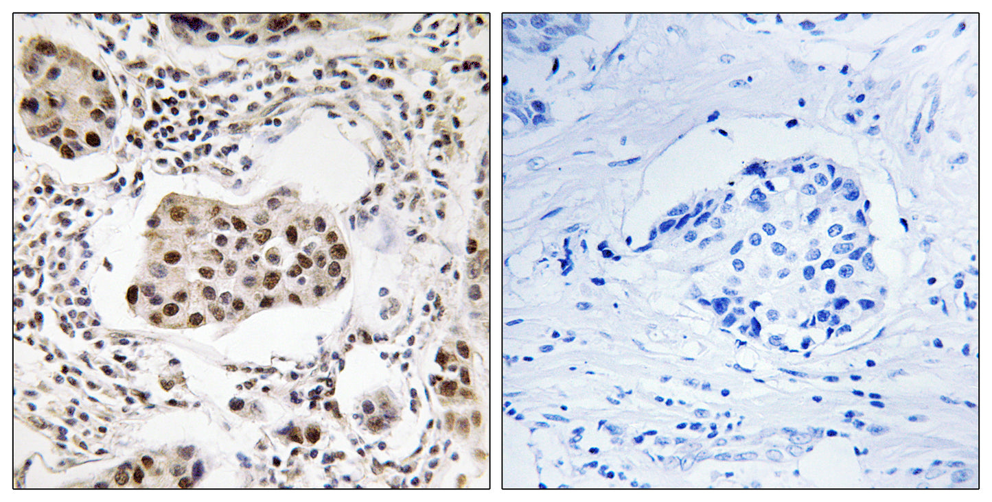 Tctex5 Rabbit Polyclonal Antibody