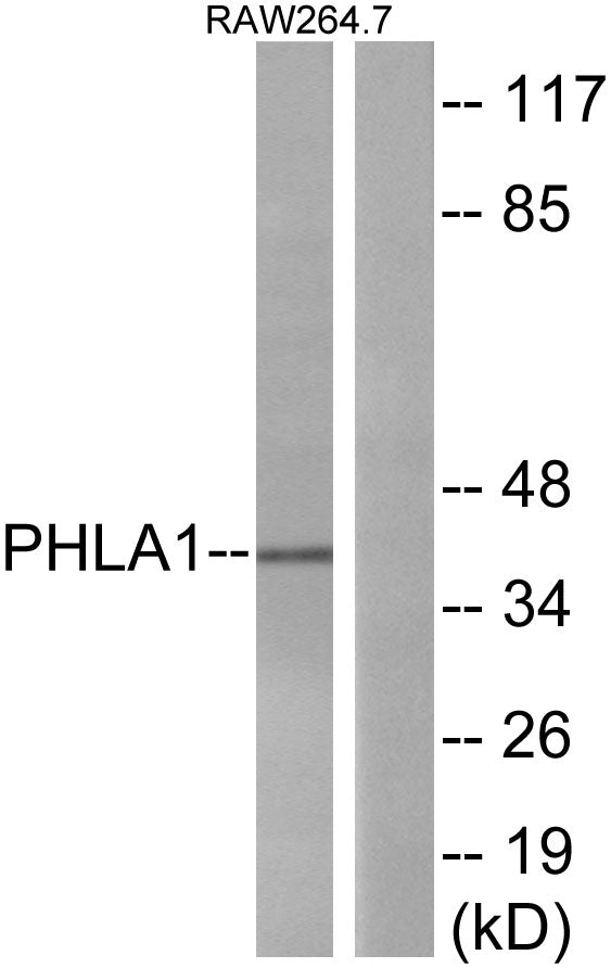 TDAG51 Rabbit Polyclonal Antibody