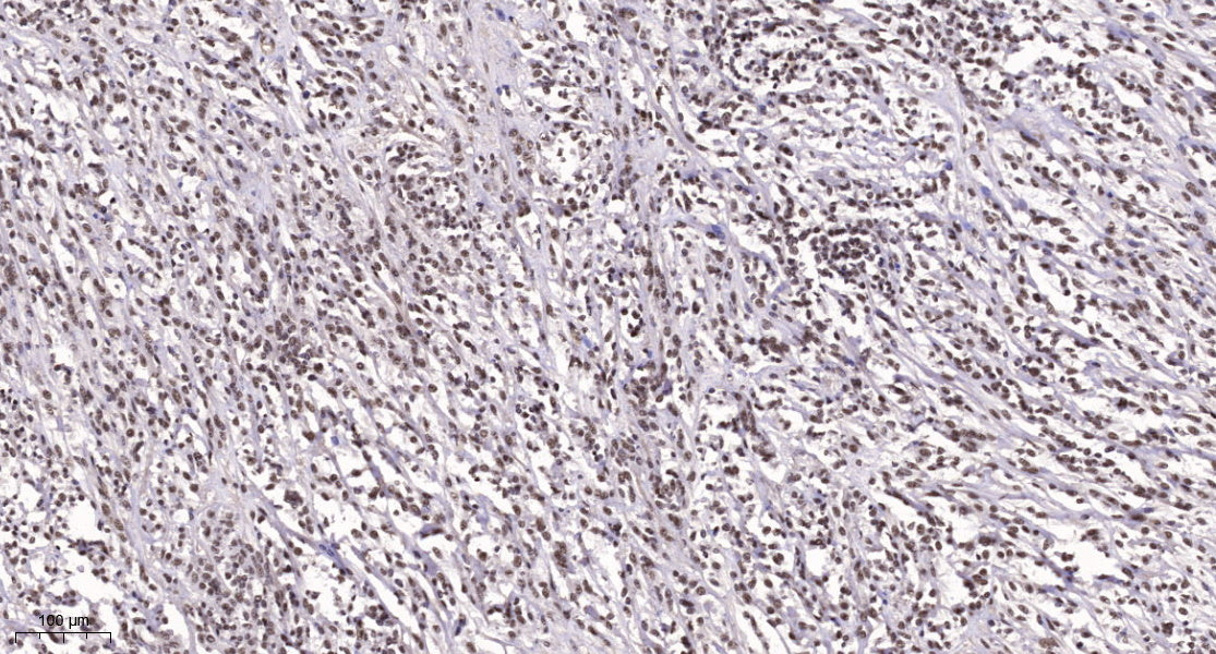 TEF-1 Rabbit Polyclonal Antibody