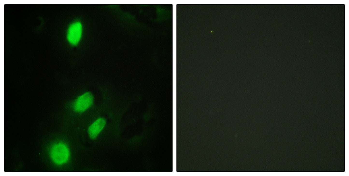 TEL Rabbit Polyclonal Antibody