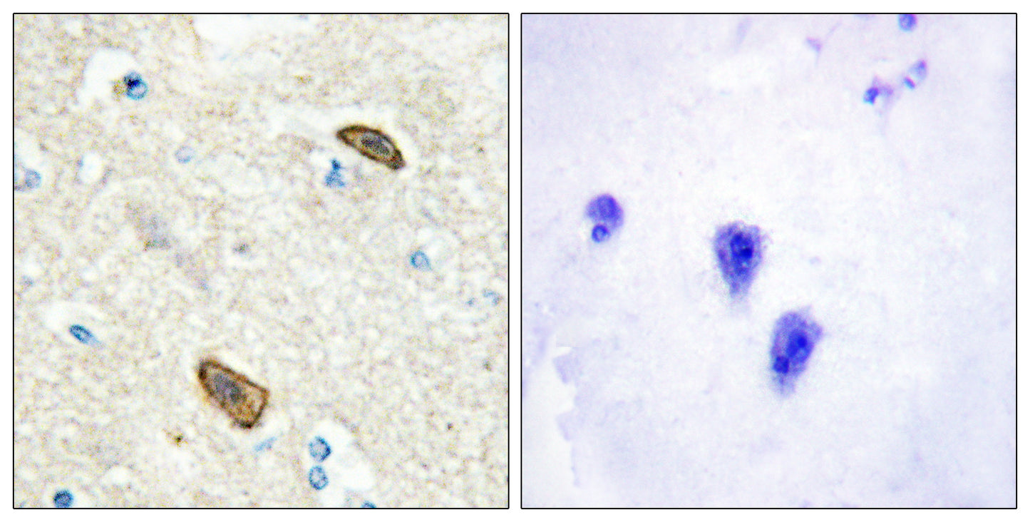 TEM7 Rabbit Polyclonal Antibody