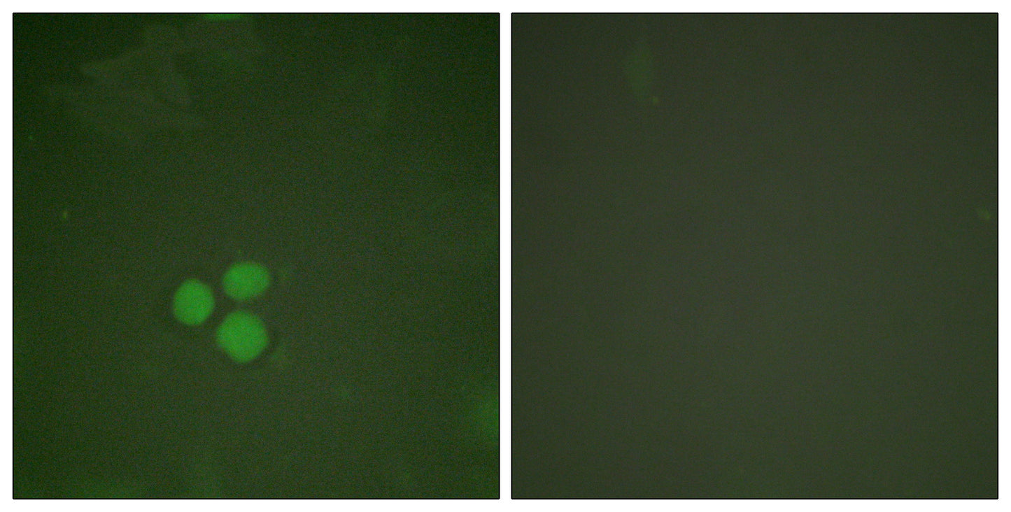 TFDP1 Rabbit Polyclonal Antibody