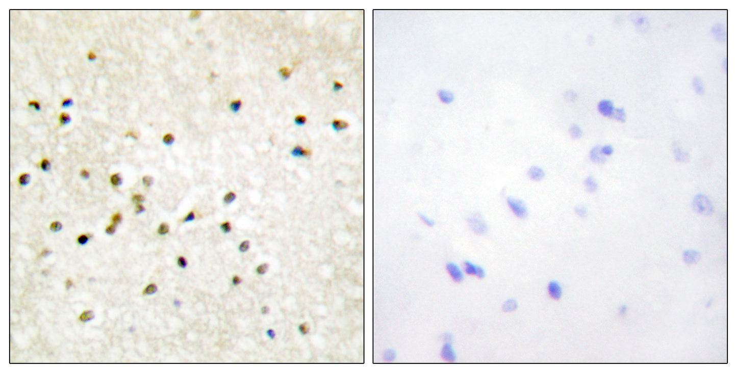 TFIIH p62 Rabbit Polyclonal Antibody