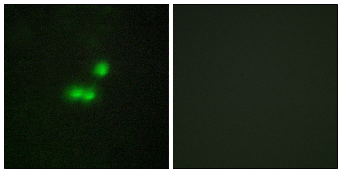 TFIIIB90-1 Rabbit Polyclonal Antibody