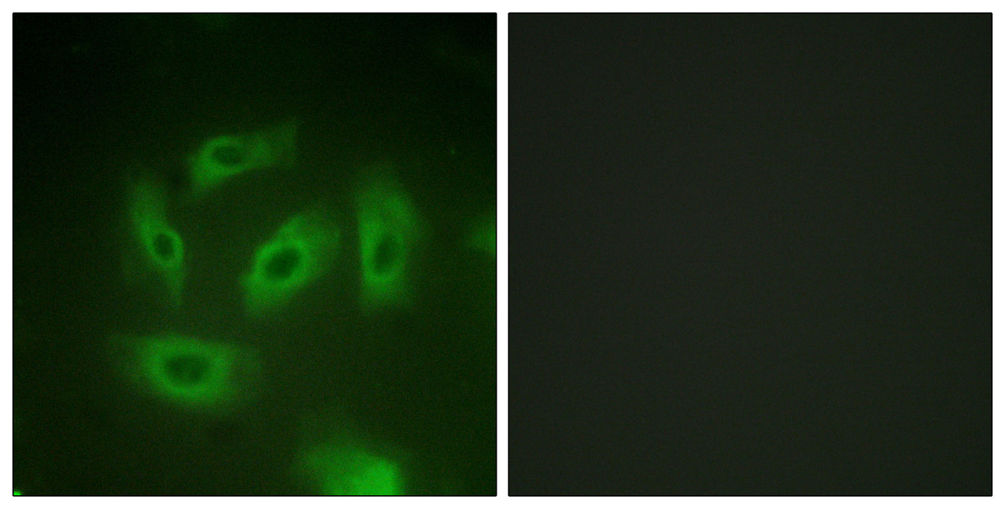 TGFβ RI Rabbit Polyclonal Antibody