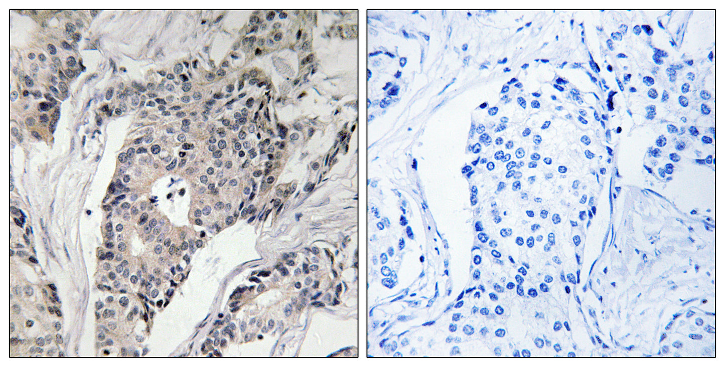 Thrombospondin 4 Rabbit Polyclonal Antibody