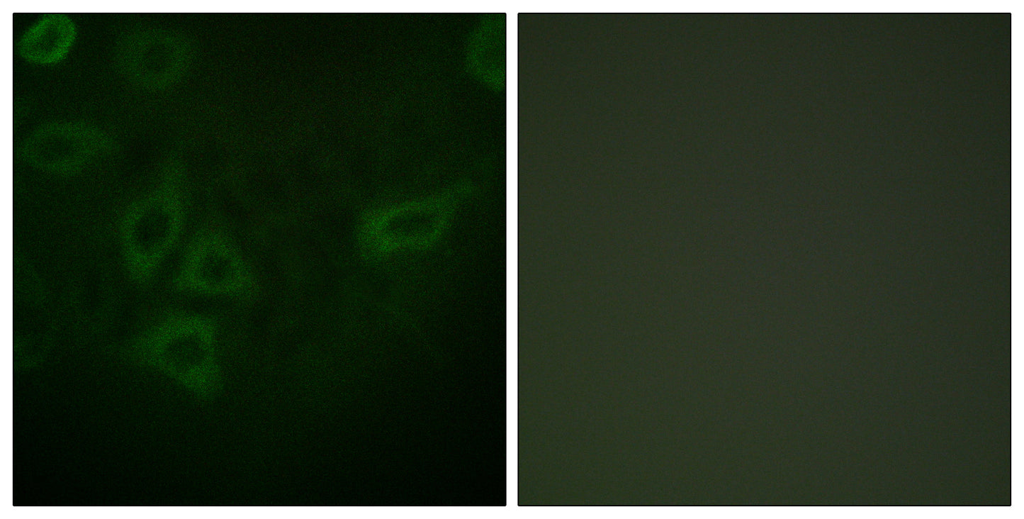 Thymidine Kinase Rabbit Polyclonal Antibody