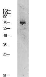 TIF-IA Rabbit Polyclonal Antibody