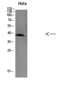 TIM-1 Rabbit Polyclonal Antibody