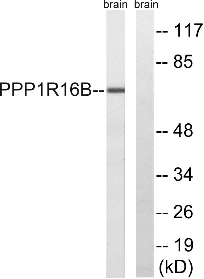TIMAP Rabbit Polyclonal Antibody