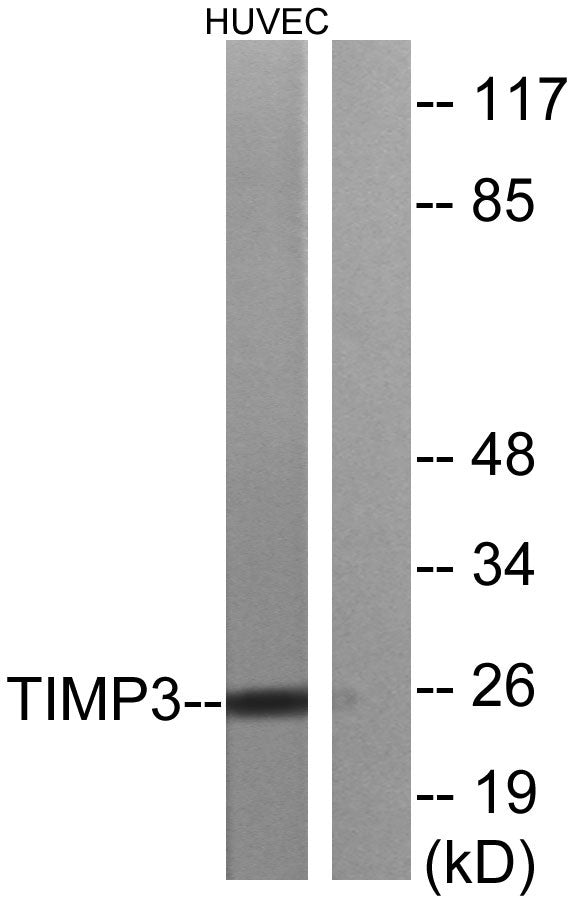 TIMP-3 Rabbit Polyclonal Antibody