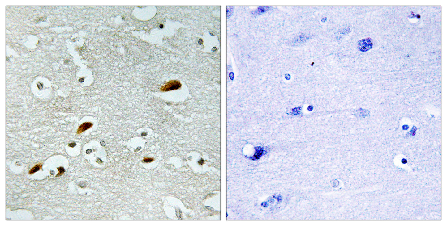 TIP60 Rabbit Polyclonal Antibody
