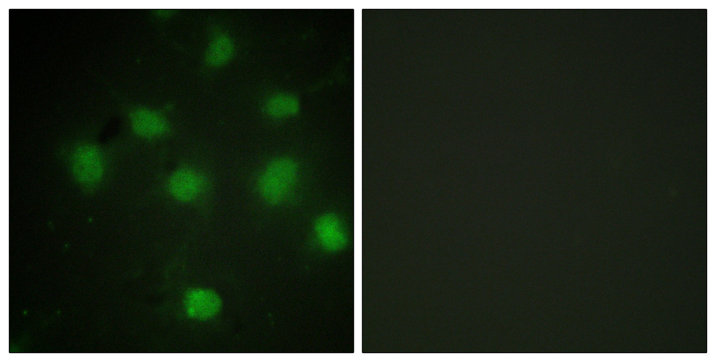 TLK1 Rabbit Polyclonal Antibody