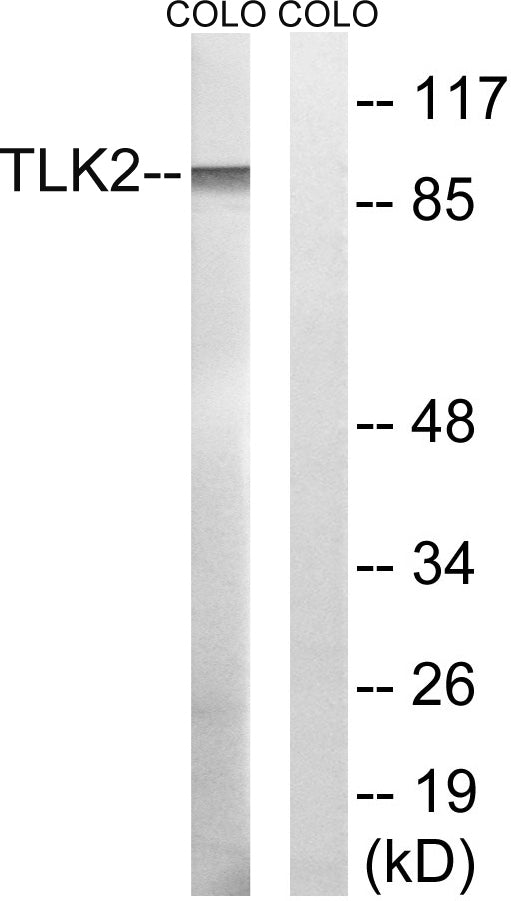TLK2 Rabbit Polyclonal Antibody