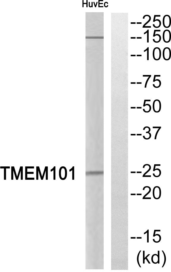 TMEM101 Rabbit Polyclonal Antibody