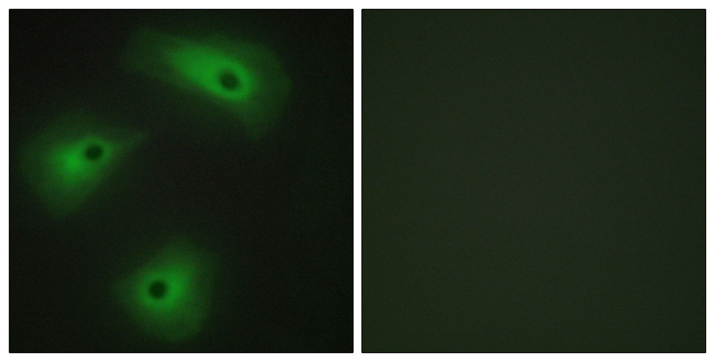TMEM16A Rabbit Polyclonal Antibody