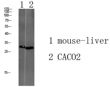 Tmem72 Rabbit Polyclonal Antibody