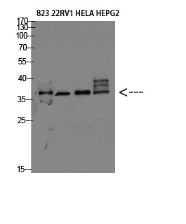 TMEPAI Rabbit Polyclonal Antibody