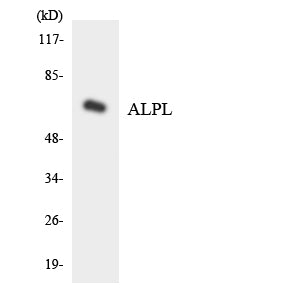 TNAP Rabbit Polyclonal Antibody