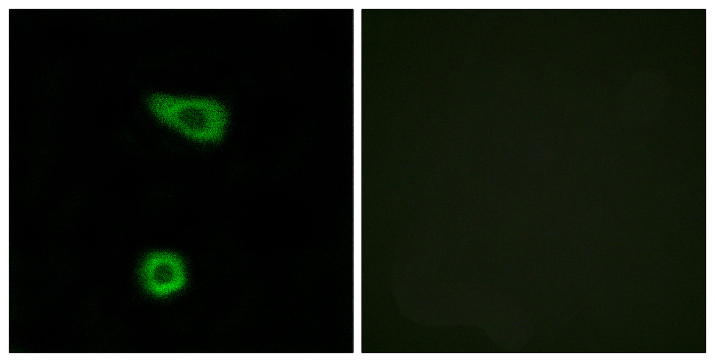TNFα-IP 2 Rabbit Polyclonal Antibody