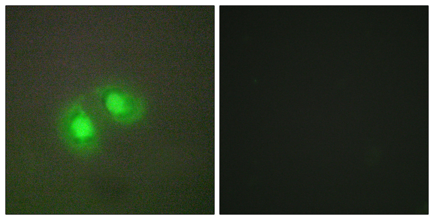 Topo IIα Rabbit Polyclonal Antibody
