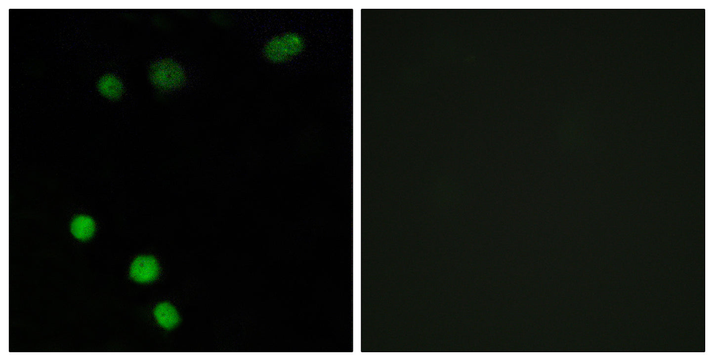 TP53INP2 Rabbit Polyclonal Antibody