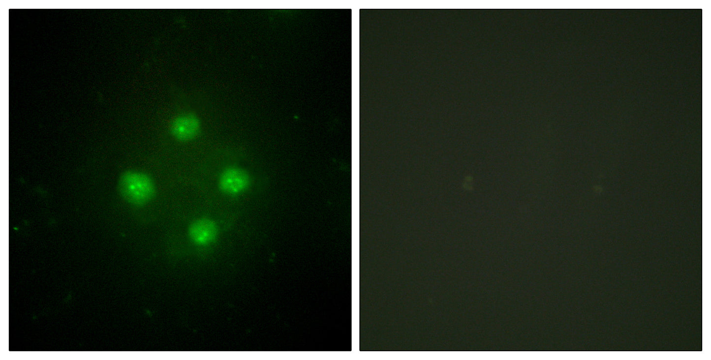 TRAP100 Rabbit Polyclonal Antibody