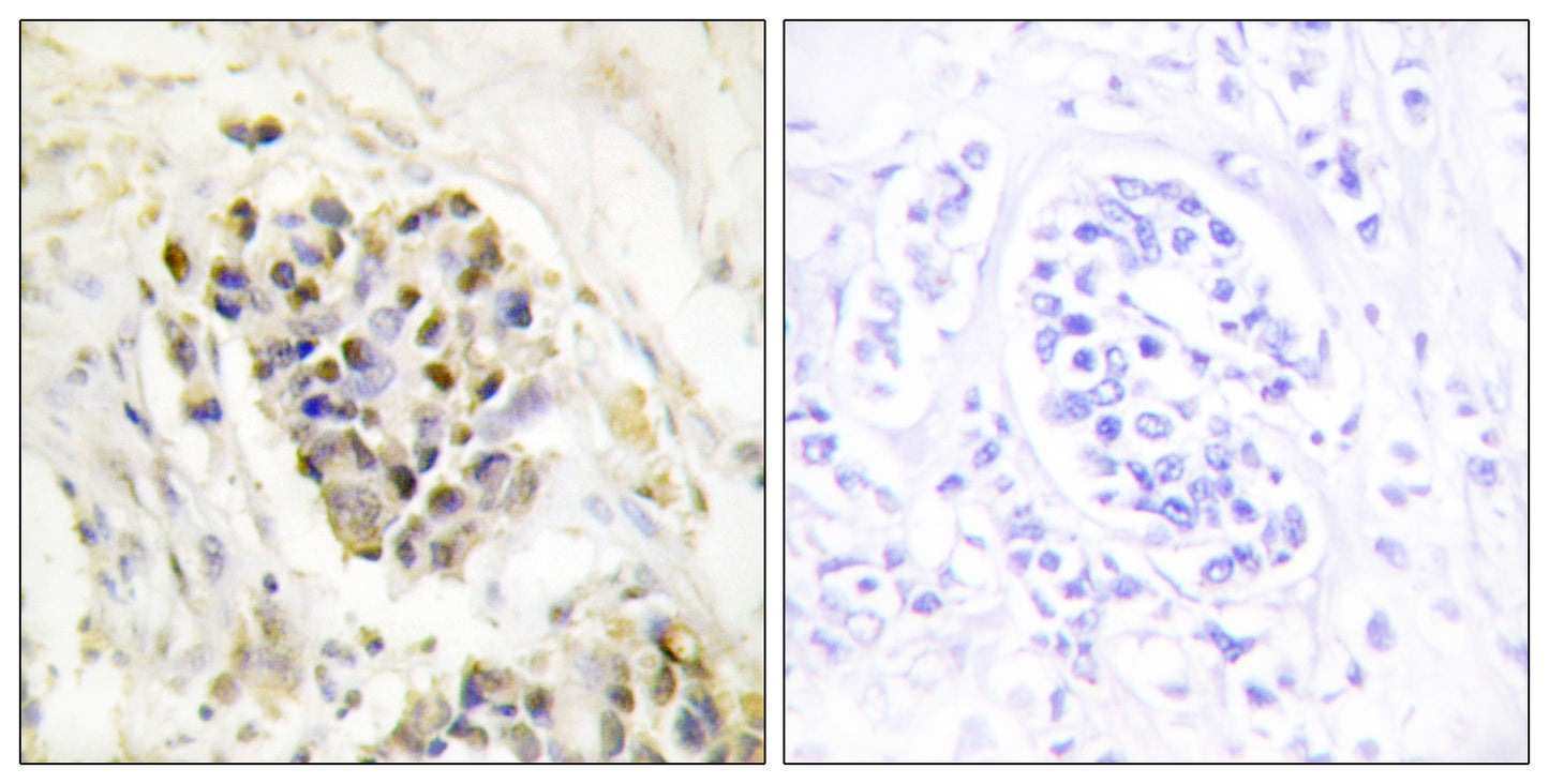 TRAP220 Rabbit Polyclonal Antibody