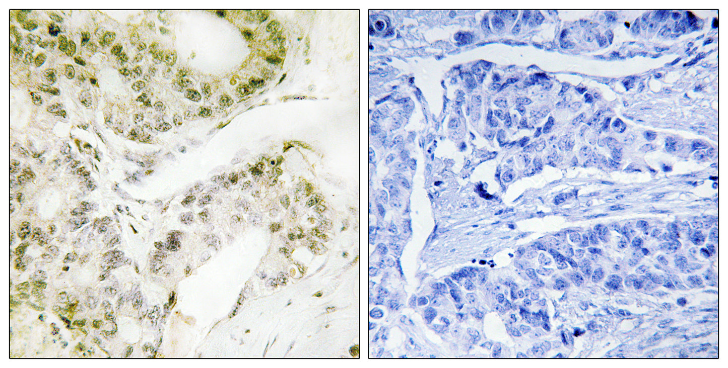 TRAP240 Rabbit Polyclonal Antibody
