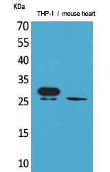 TREM-1 Rabbit Polyclonal Antibody