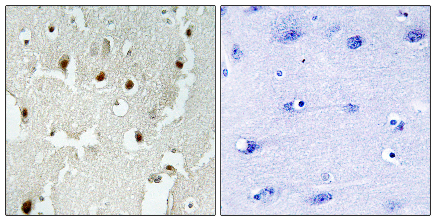 TReP-132 Rabbit Polyclonal Antibody