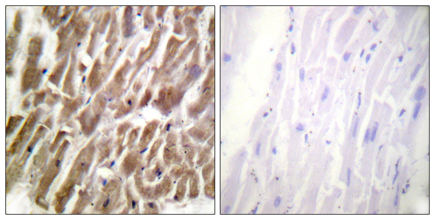 Troponin I-C Rabbit Polyclonal Antibody